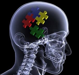 çcerebro